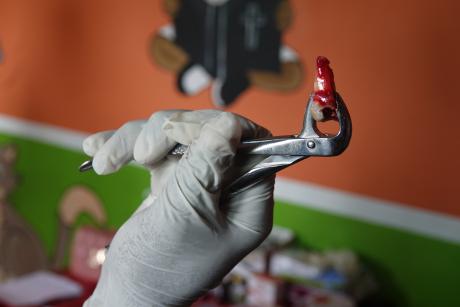 Over a hundred people had their bad teeth extracted 